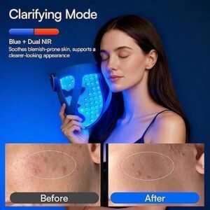 Glow 4D LED Mask with 320 LEDs, Dual NIR, 4 Light Modes, Under-Eye Cooling and Rechargeable Cordless Design, Blue - Image 2